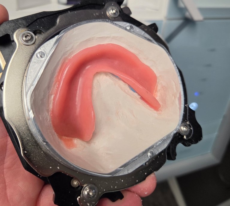 Finished denture reline after milling