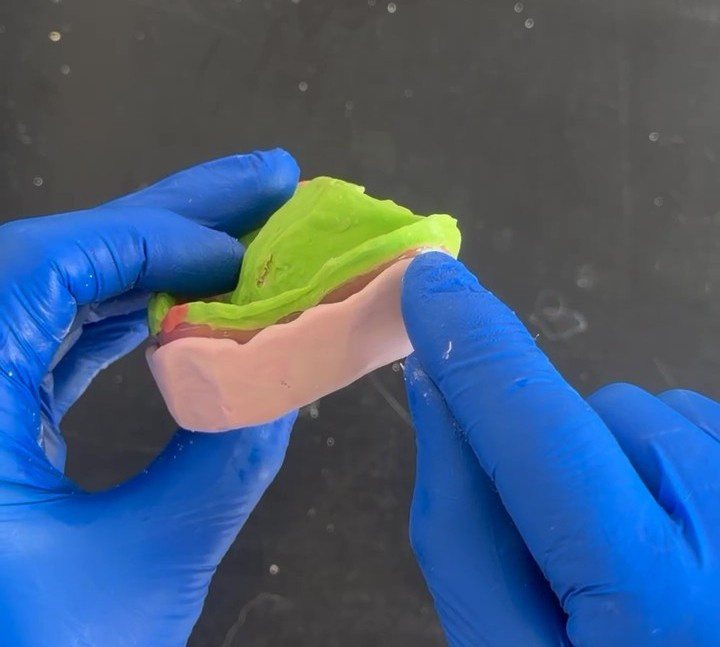 Gloved hands applying green lab putty over a pink prosthetic