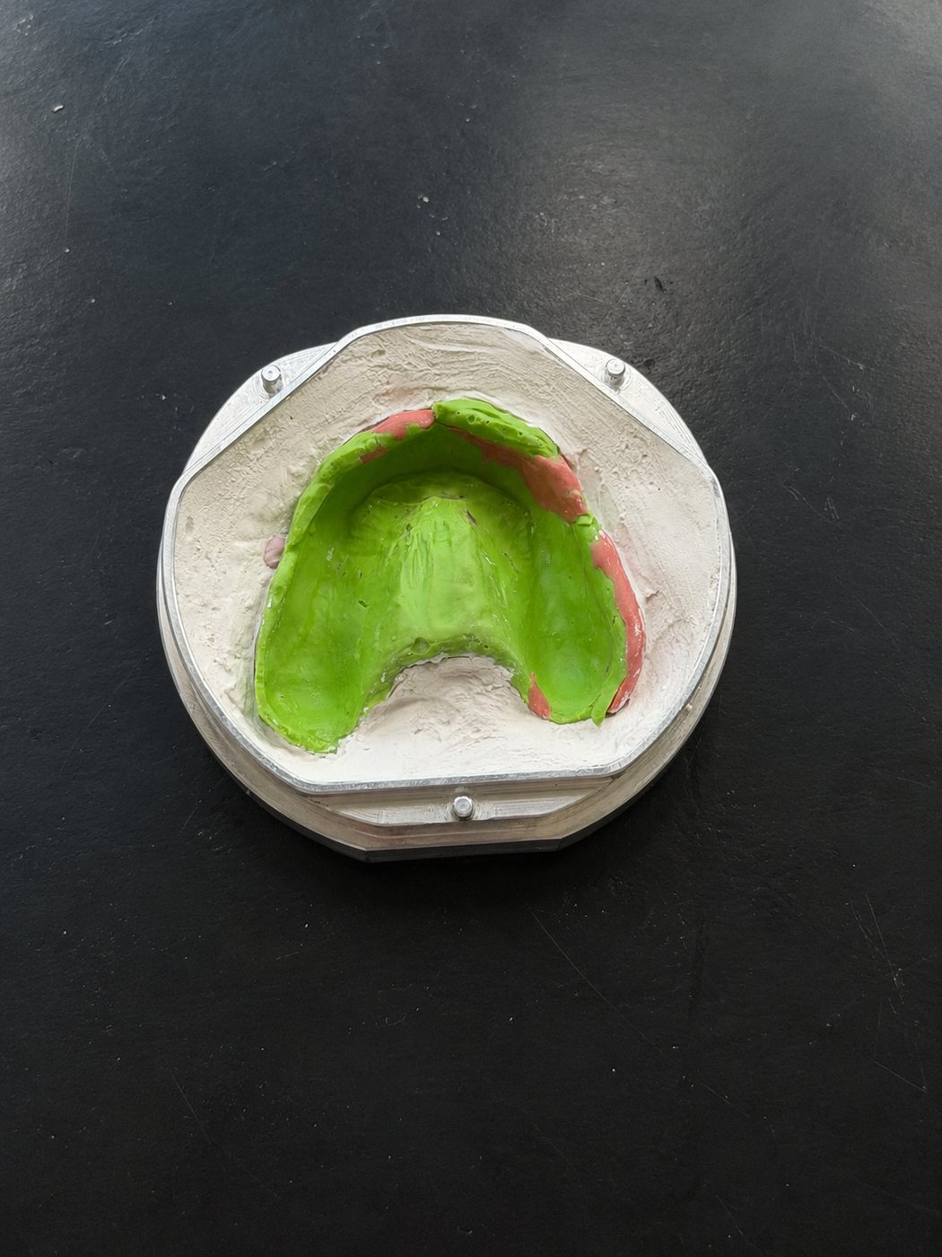 Flask with alignment posts, showing the prosthetic flush in the plaster